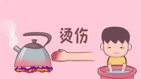 手被开水烫伤了怎么办？（冰敷是有效的急救措施吗？）